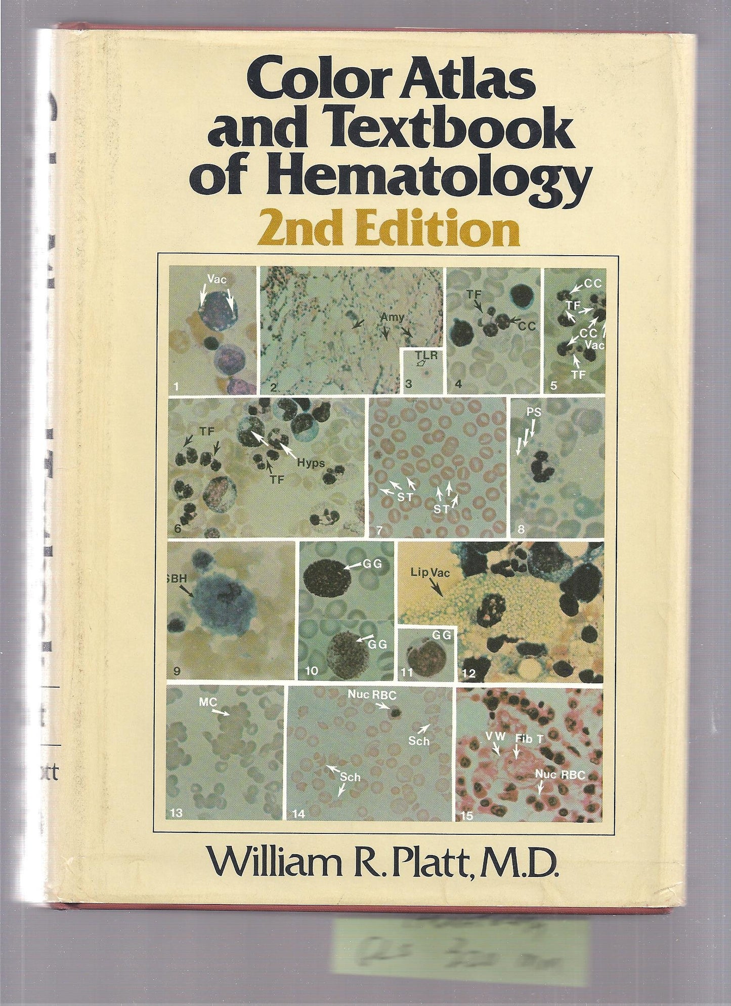Color Atlas and Textbook of Hematology