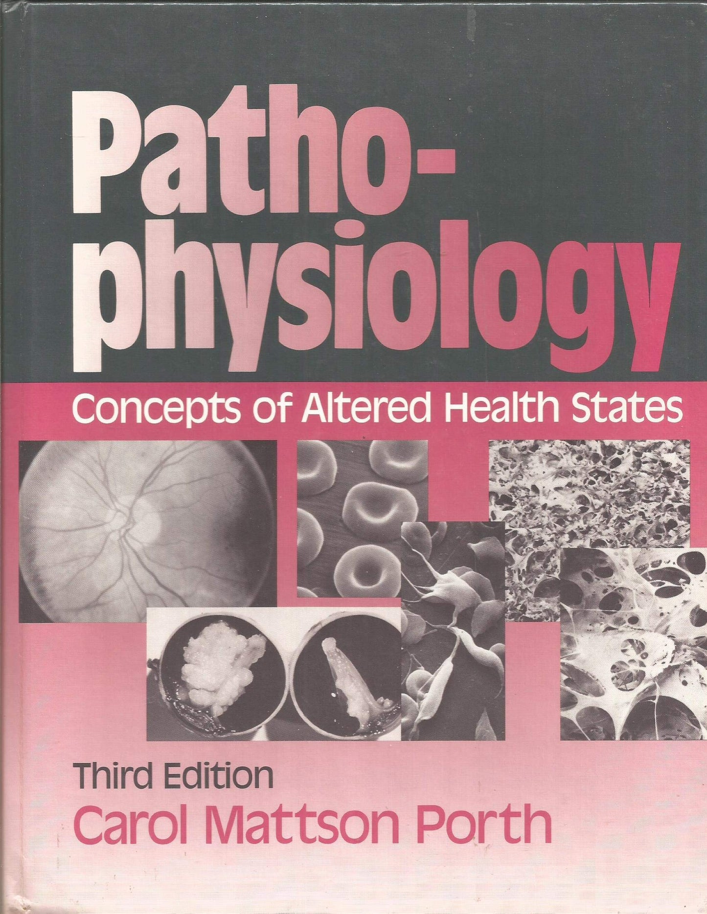 Pathophysiology: Concepts of Altered Health States