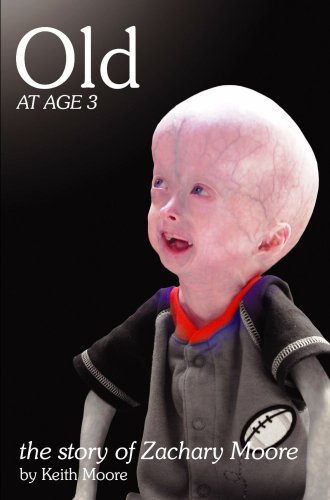 Old At Age 3 by Keith Moore (2007-09-18)