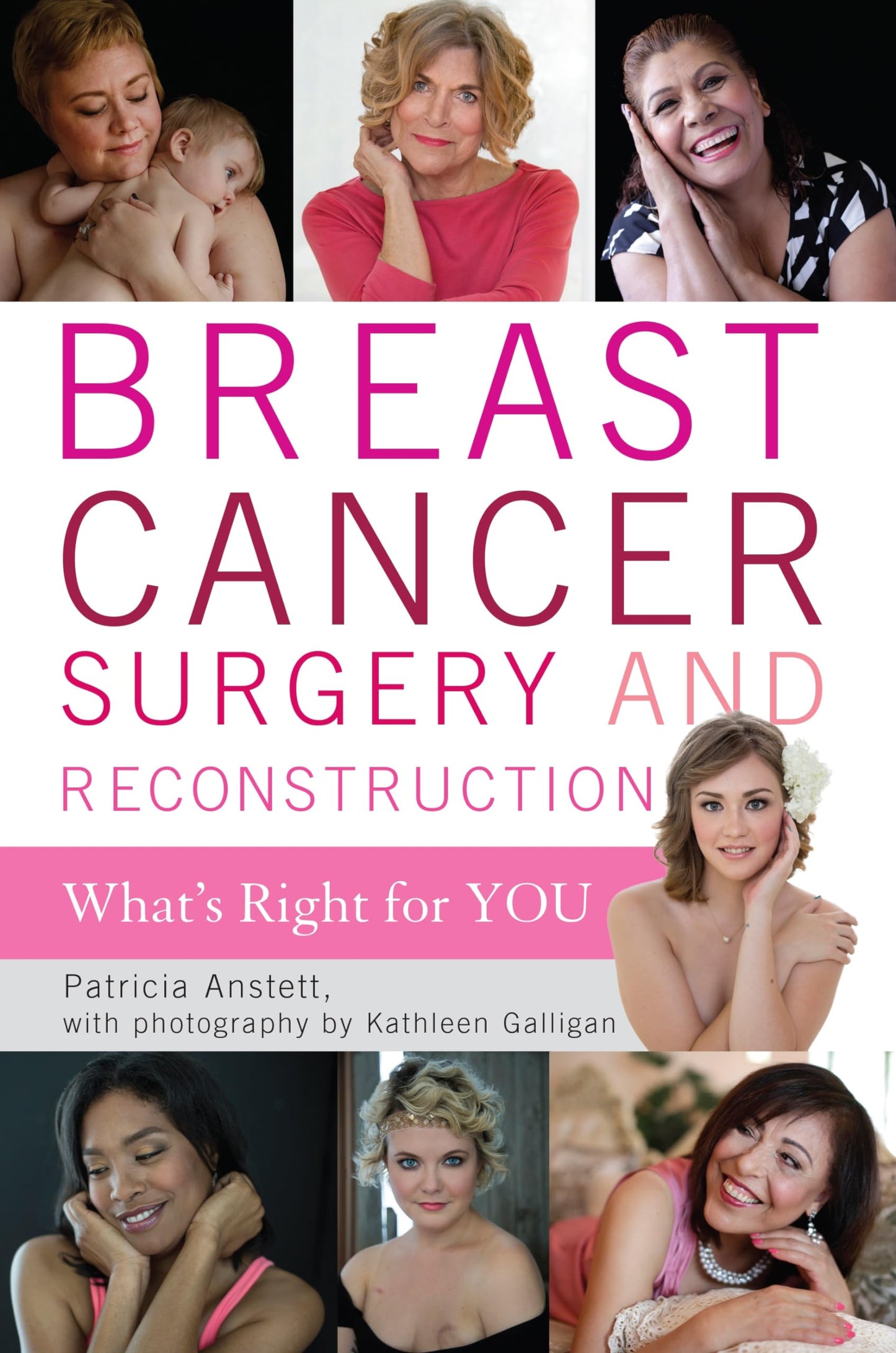 Breast Cancer Surgery and Reconstruction: What's Right For You