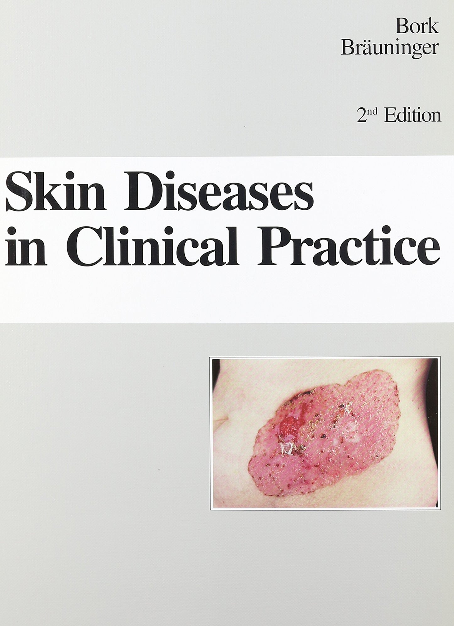 Skin Diseases in Clinical Practice