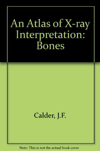 An Atlas of Radiological Interpretation: The Bones