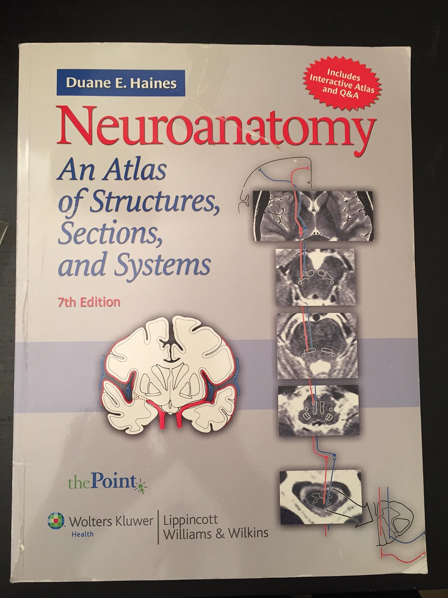 Neuroanatomy: An Atlas of Structures, Sections, and Systems