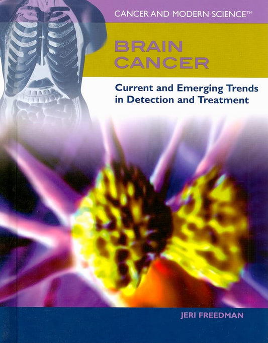 Brain Cancer: Current and Emerging Trends in Detection and Treatment (Cancer and Modern Science)