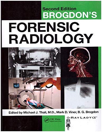 Brogdon's Forensic Radiology 2nd Edition