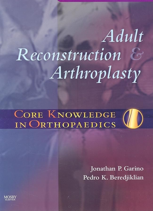 Core Knowledge in Orthopaedics: Adult Reconstruction and Arthroplasty